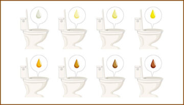 urine color