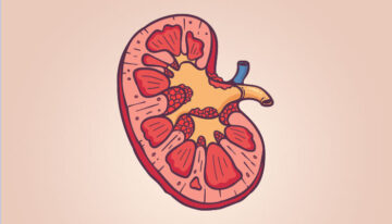 kidney disease